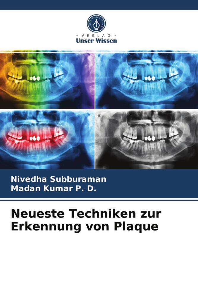 Neueste Techniken zur Erkennung von Plaque