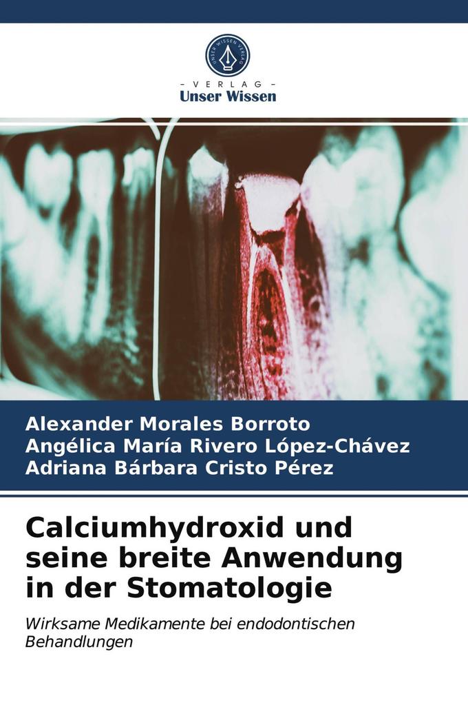 Calciumhydroxid und seine breite Anwendung in der Stomatologie