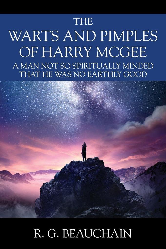 The Warts and Pimples of Harry McGee