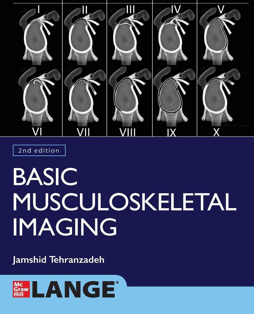 Basic Musculoskeletal Imaging Second Edition