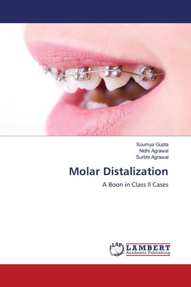 Molar Distalization
