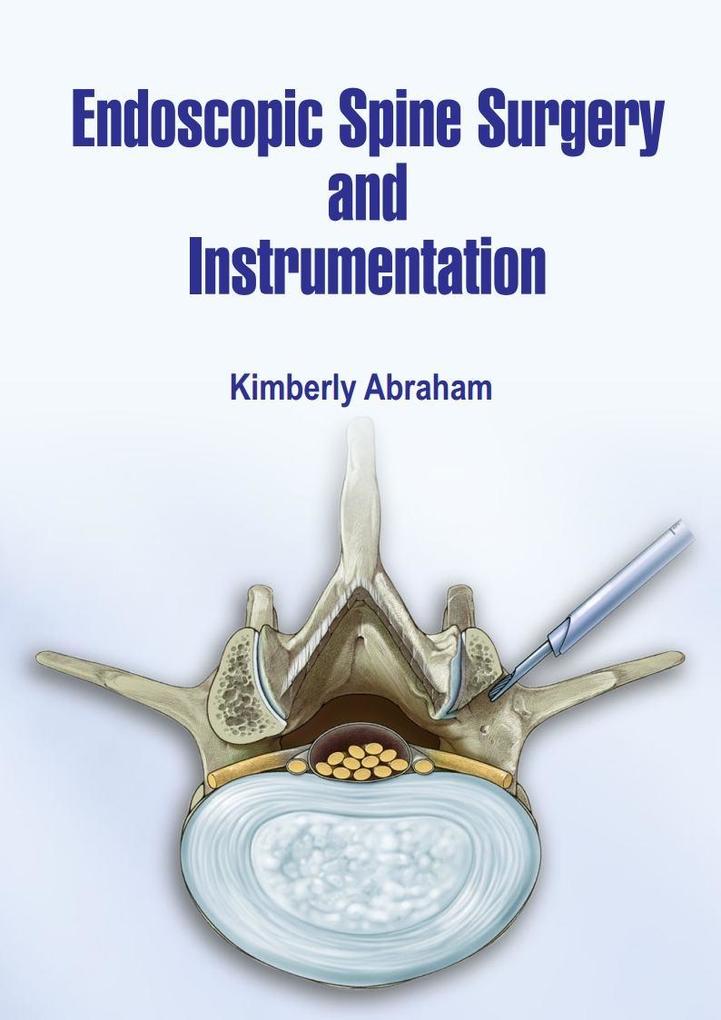 Endoscopic Spine Surgery and Instrumentation