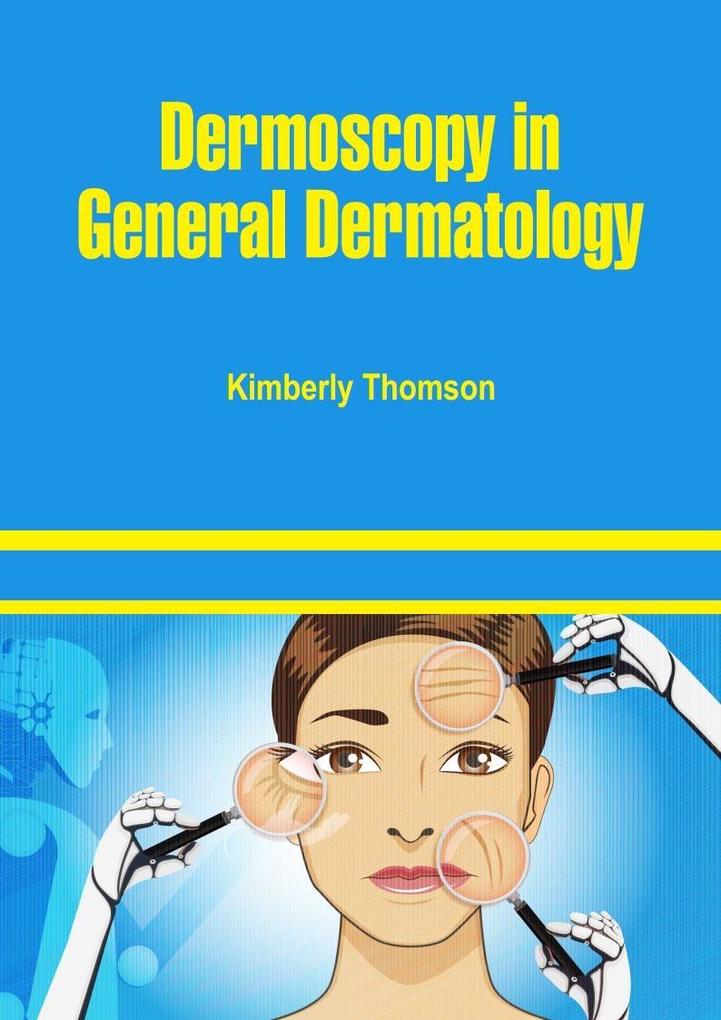 Dermoscopy in General Dermatology
