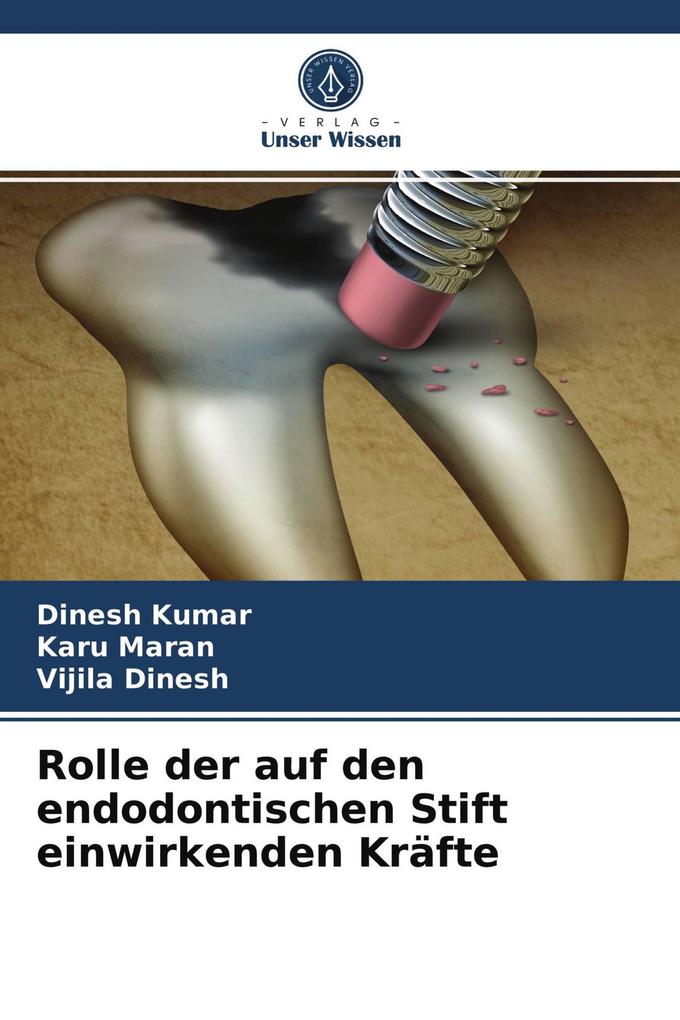 Rolle der auf den endodontischen Stift einwirkenden Kräfte