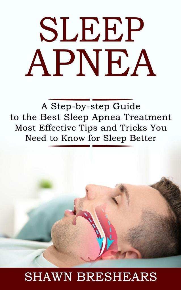 Sleep Apnea