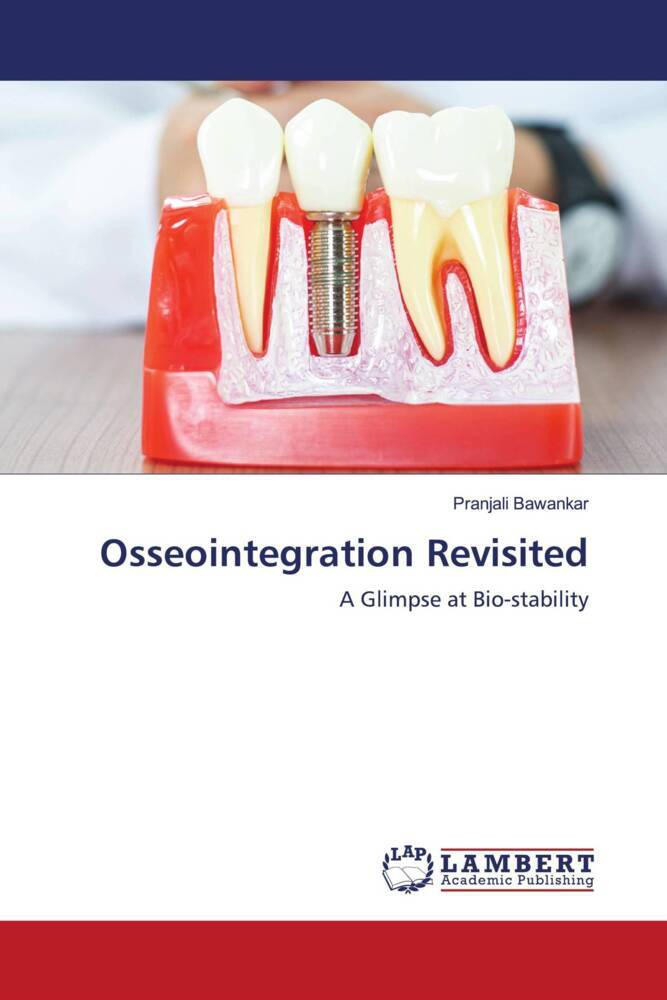 Osseointegration Revisited