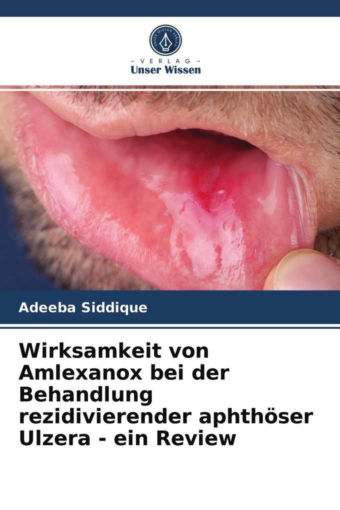Wirksamkeit von Amlexanox bei der Behandlung rezidivierender aphthöser Ulzera - ein Review