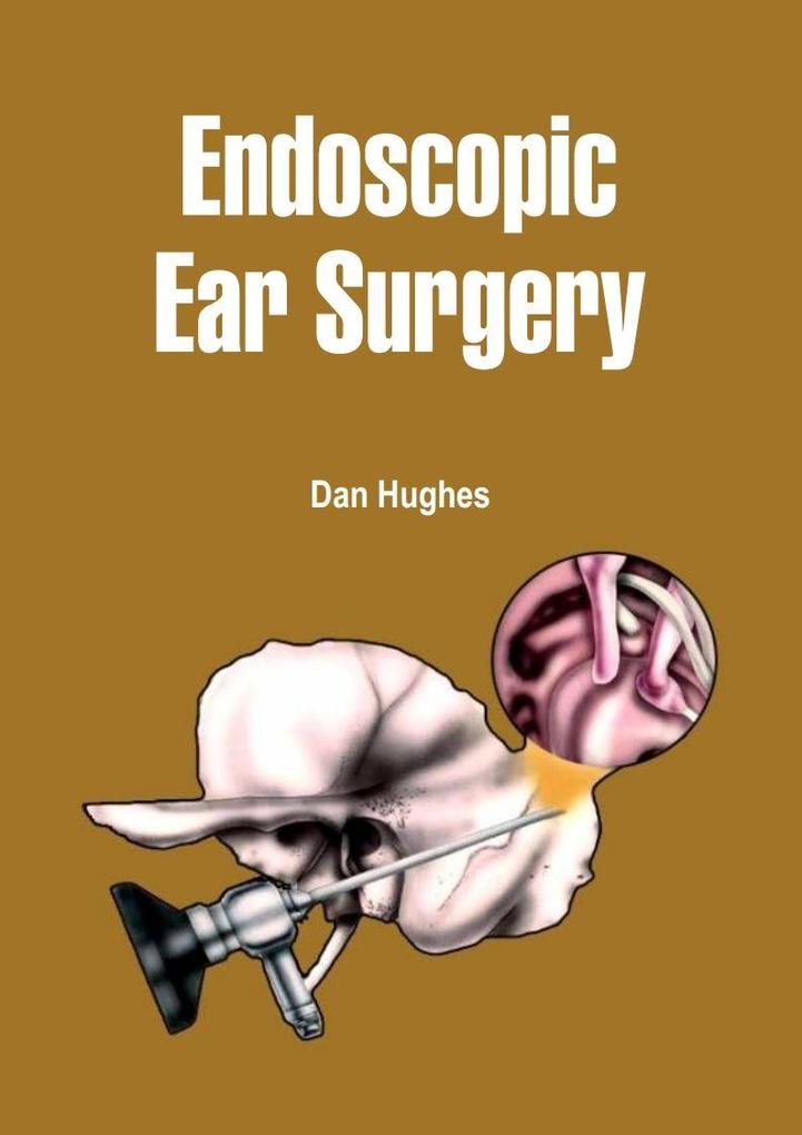 Endoscopic Ear Surgery