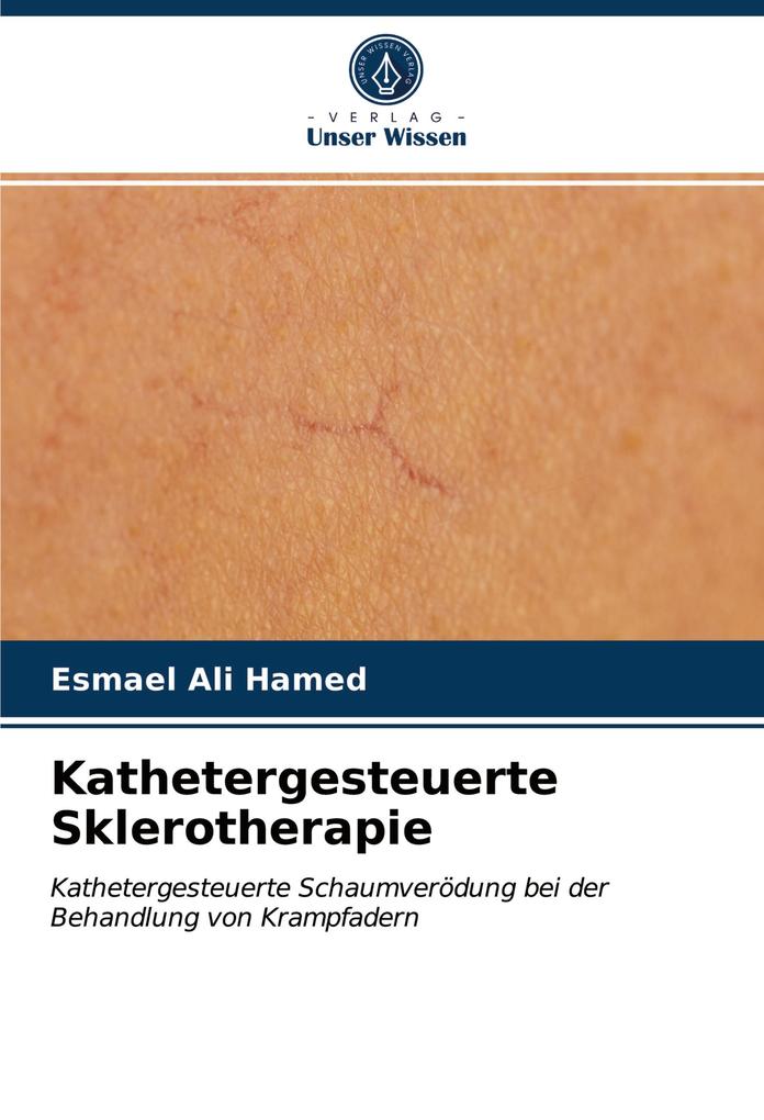 Kathetergesteuerte Sklerotherapie