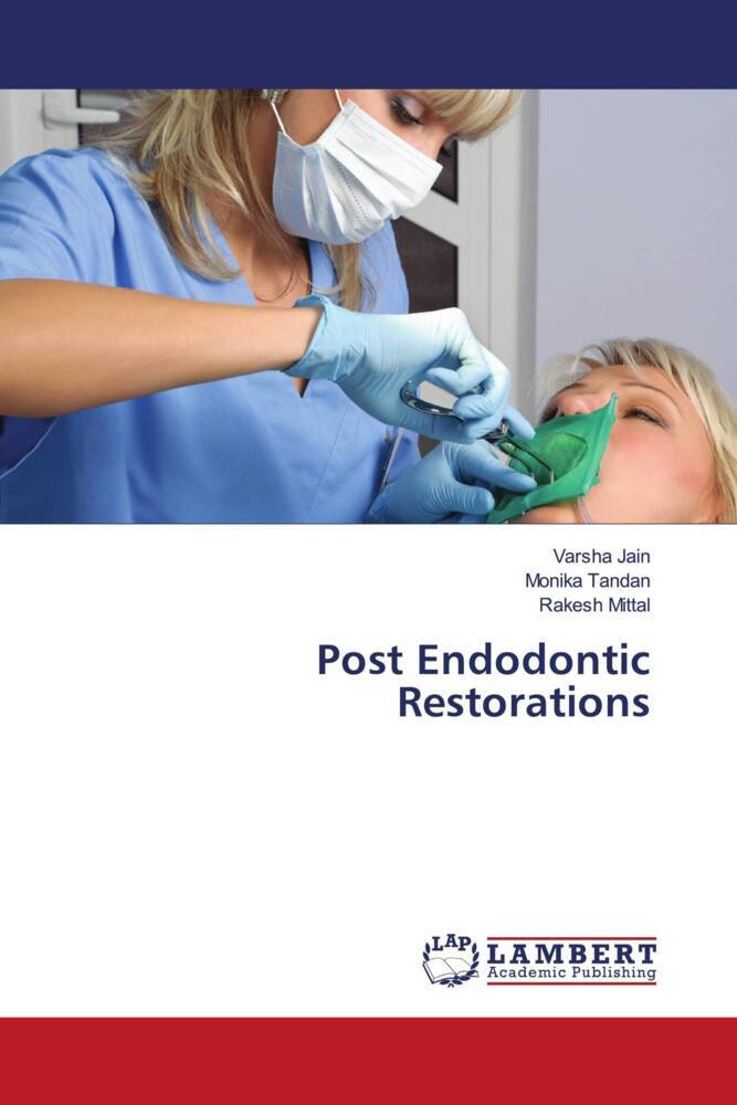 Post Endodontic Restorations