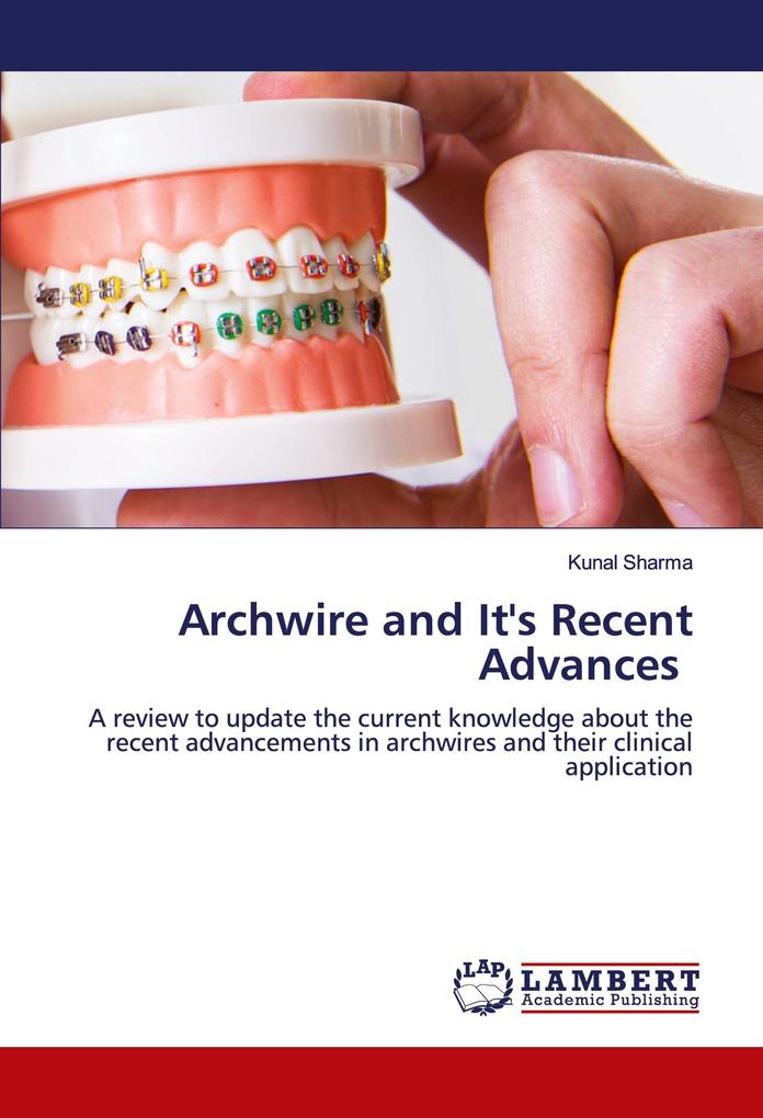 Archwire and It's Recent Advances