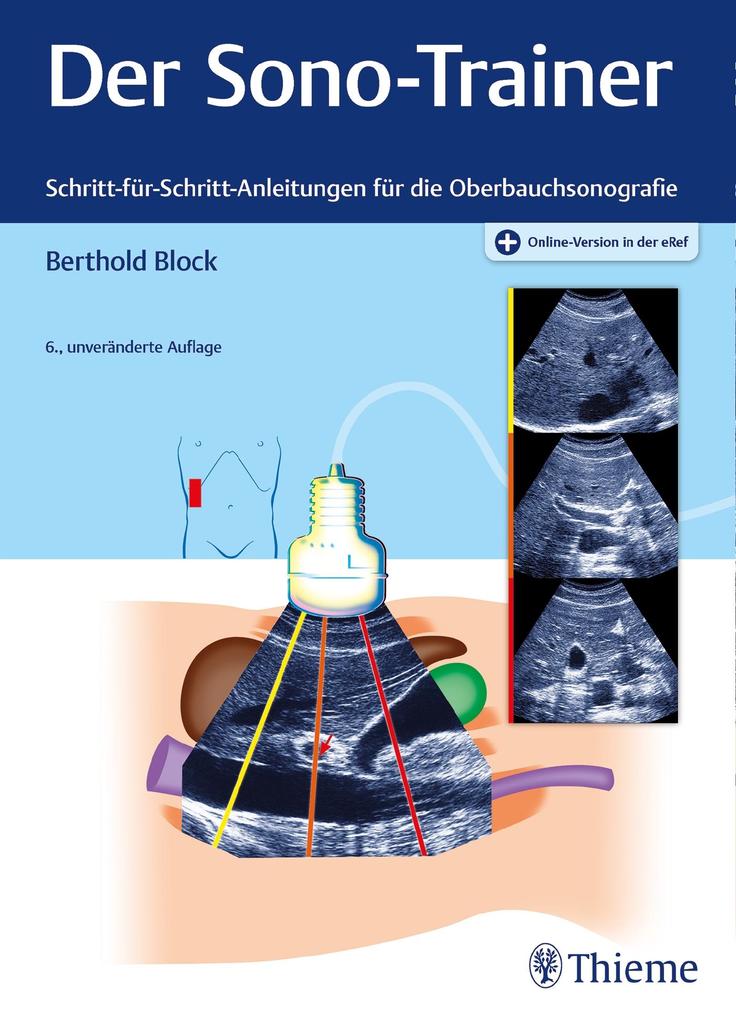 Der Sono-Trainer: Schritt-für-Schritt-Anleitungen für die Oberbauchsonografie - Bild 5