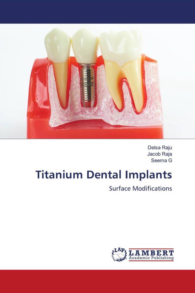Titanium Dental Implants