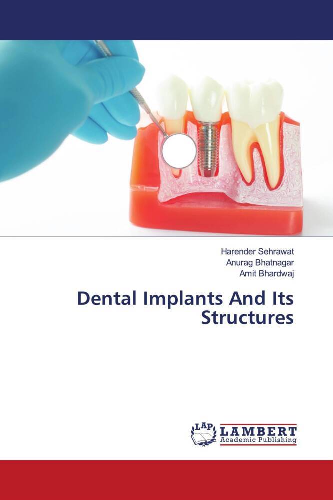 Dental Implants And Its Structures