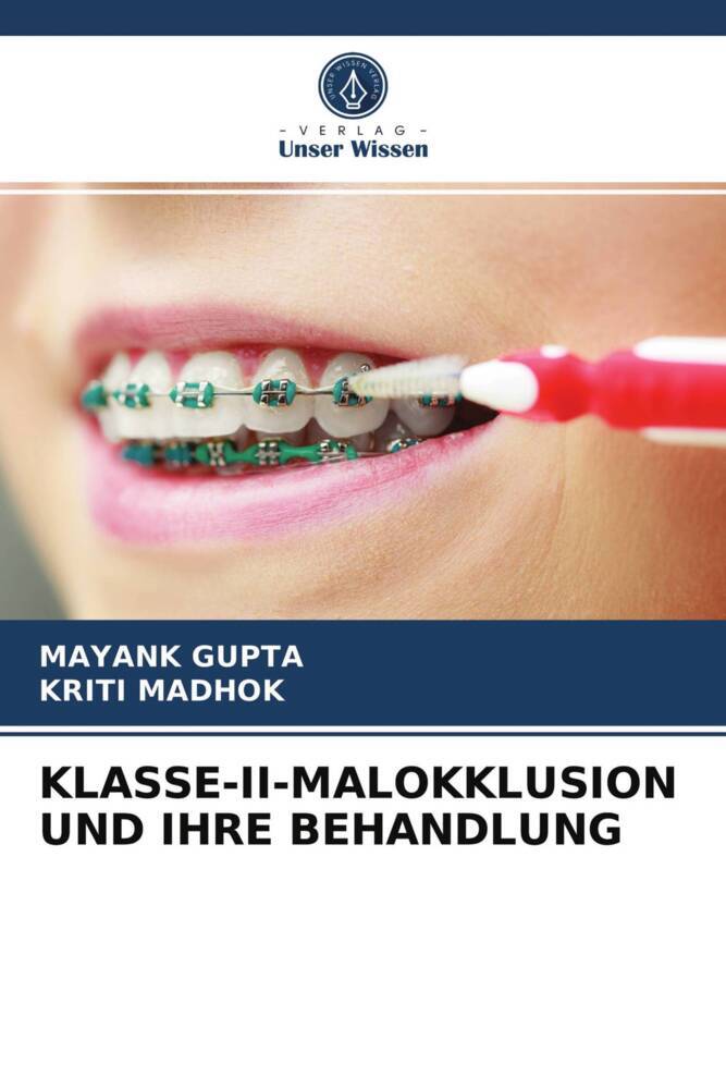 KLASSE-II-MALOKKLUSION UND IHRE BEHANDLUNG