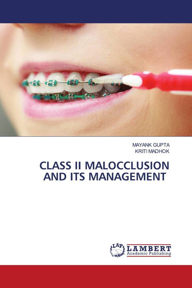 CLASS II MALOCCLUSION AND ITS MANAGEMENT