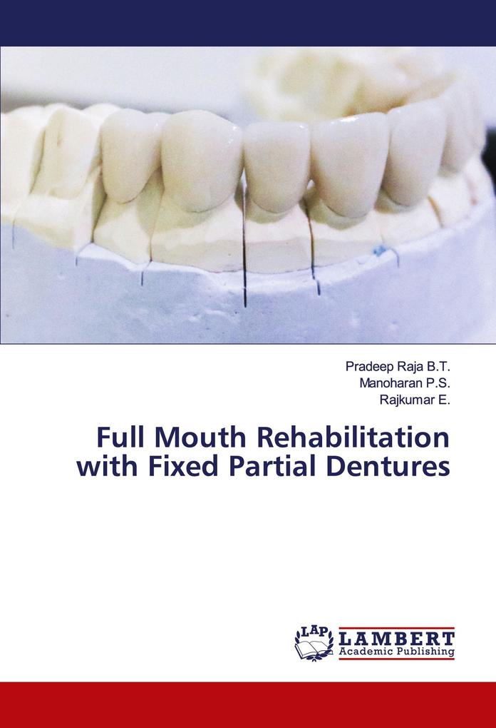 Full Mouth Rehabilitation with Fixed Partial Dentures