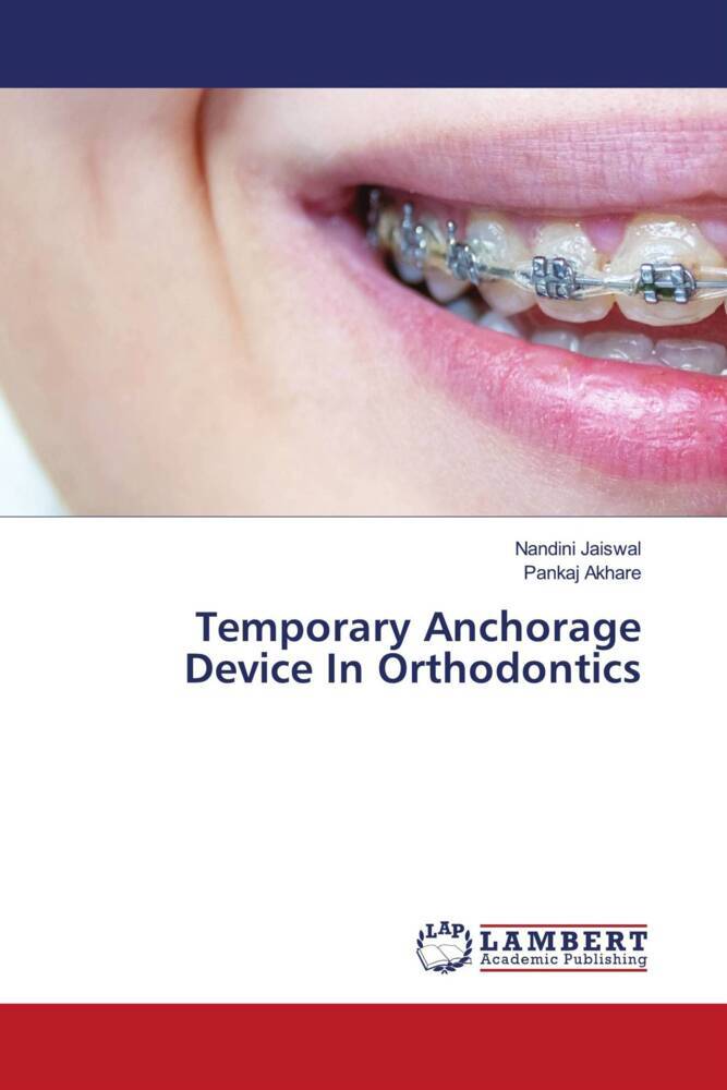 Temporary Anchorage Device In Orthodontics