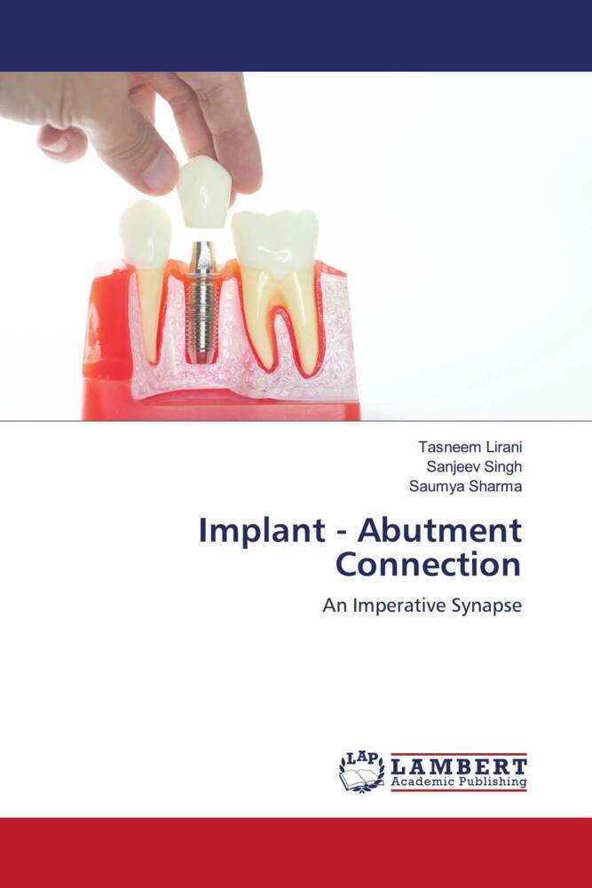 Implant - Abutment Connection