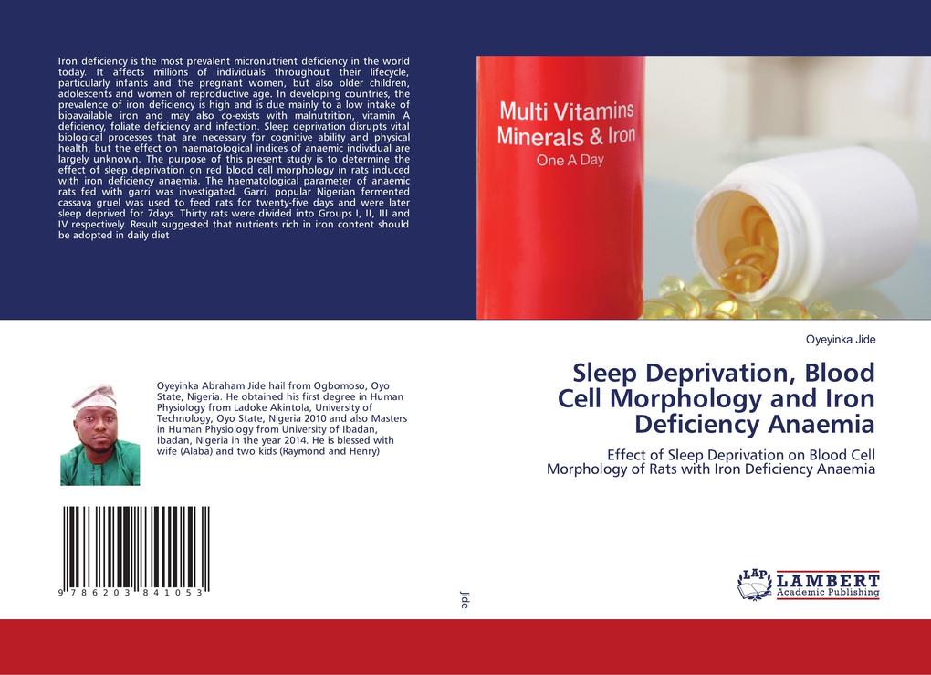 Sleep Deprivation Blood Cell Morphology and Iron Deficiency Anaemia
