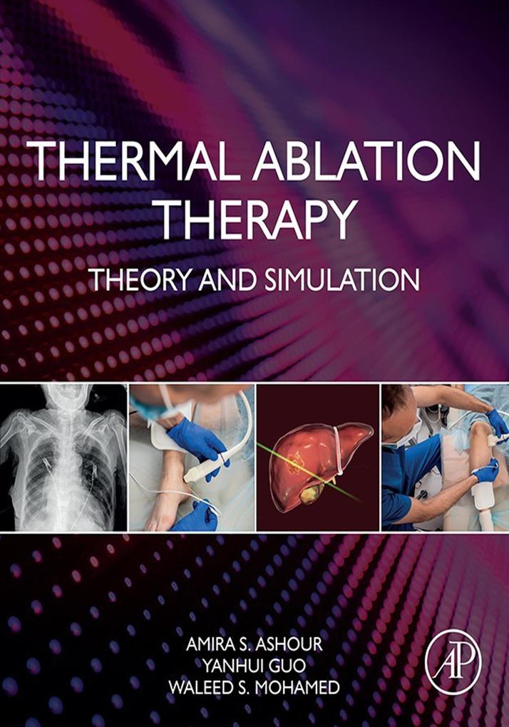 Thermal Ablation Therapy