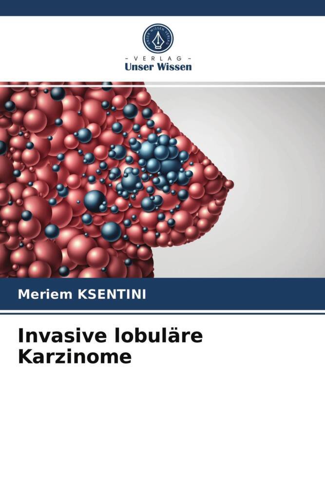 Invasive lobuläre Karzinome