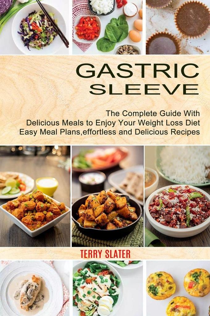 Gastric Sleeve