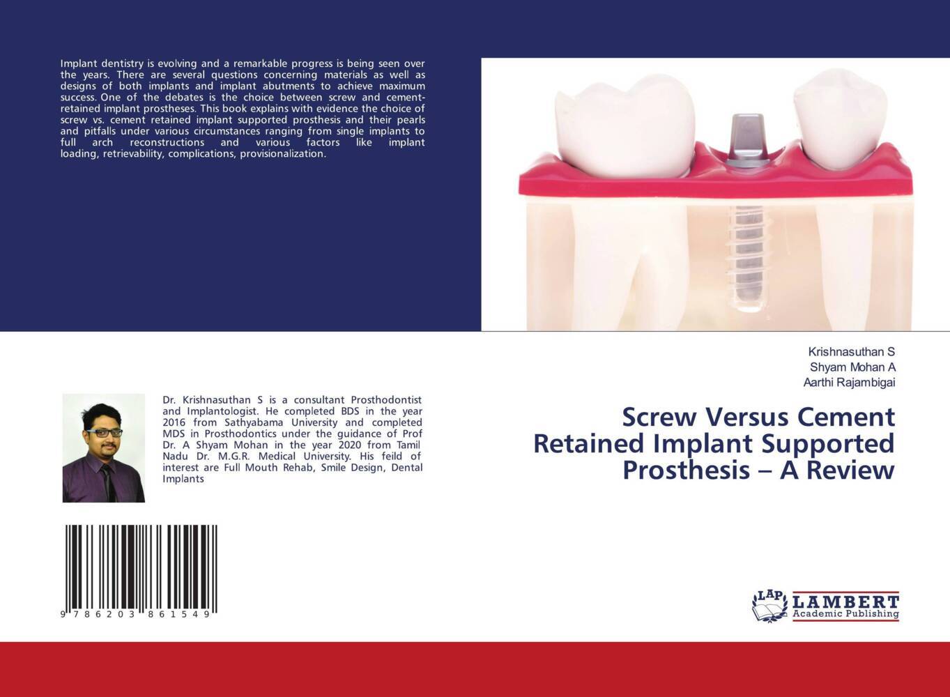 Screw Versus Cement Retained Implant Supported Prosthesis - A Review