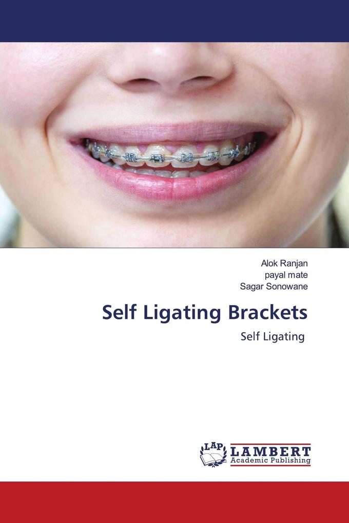 Self Ligating Brackets