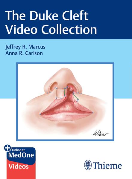 The Duke Cleft Video Collection