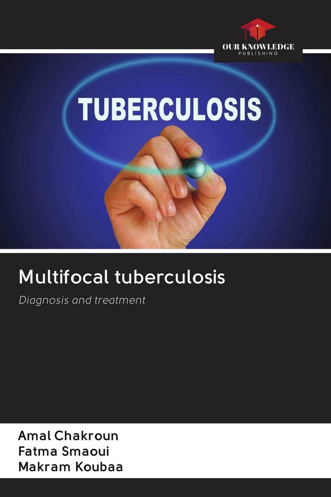 Multifocal tuberculosis