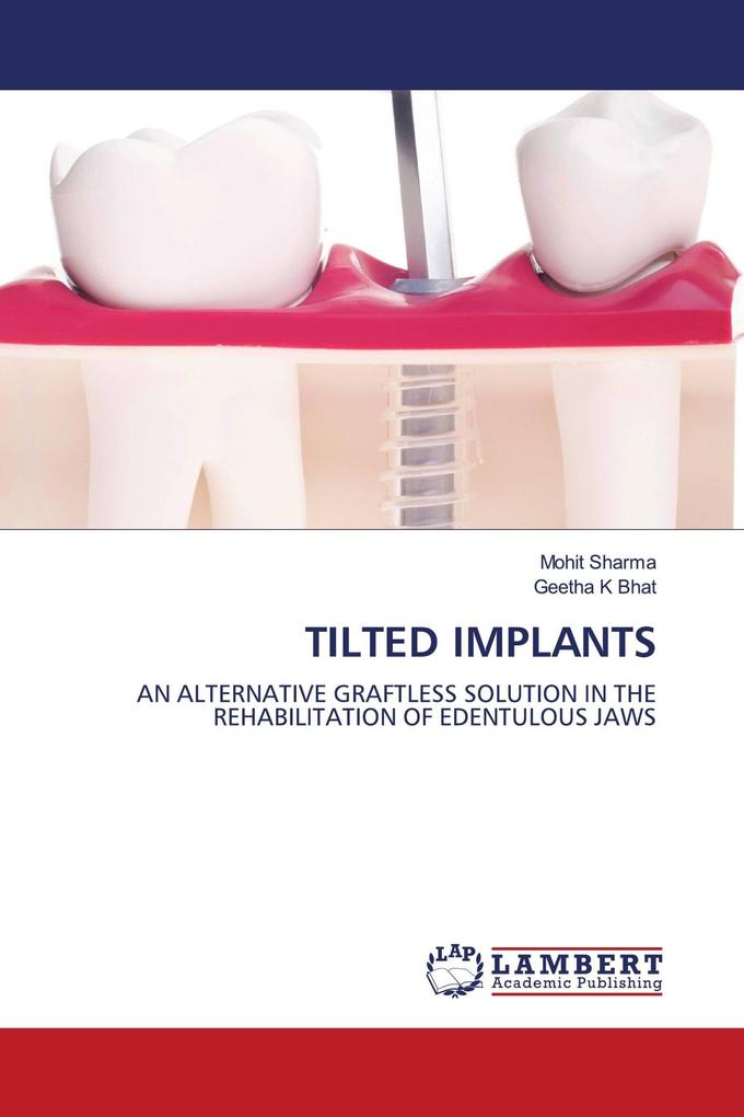Tilted Implants