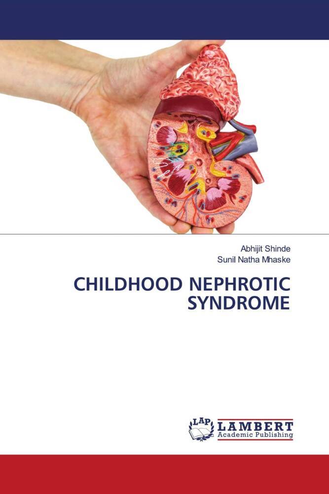 CHILDHOOD NEPHROTIC SYNDROME