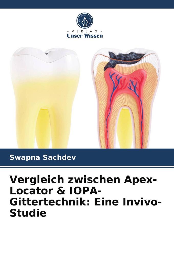 Vergleich zwischen Apex-Locator & IOPA-Gittertechnik: Eine Invivo-Studie