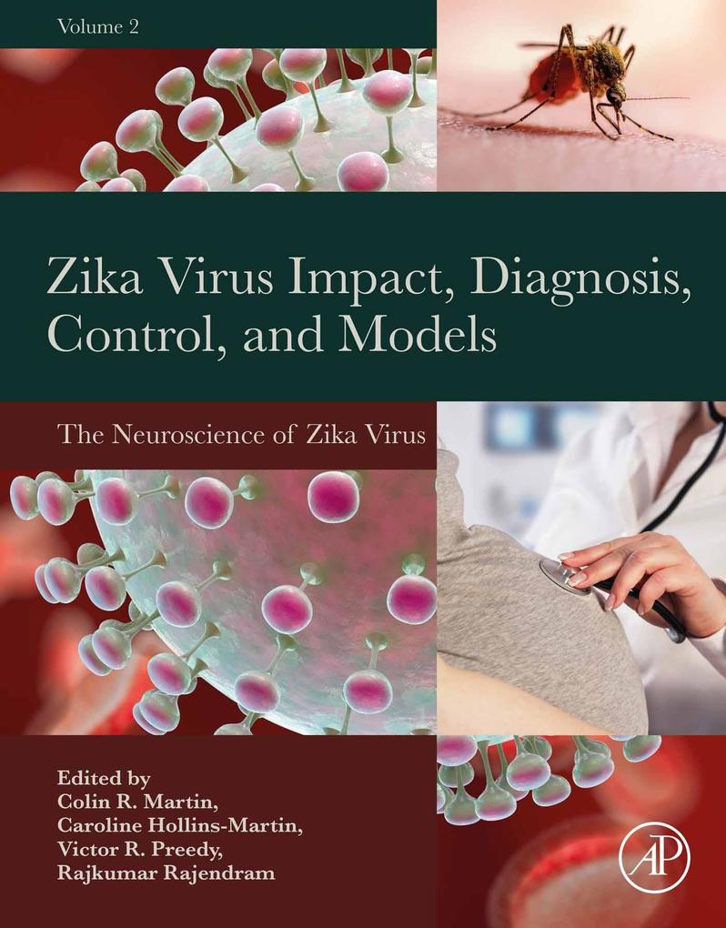 Zika Virus Impact Diagnosis Control and Models