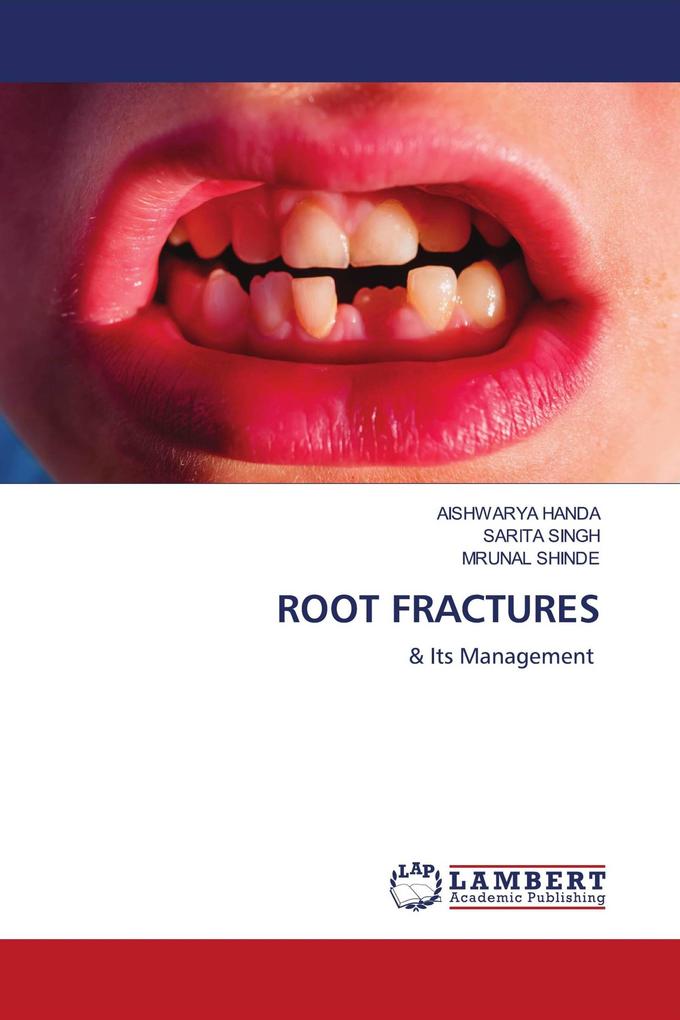 ROOT FRACTURES