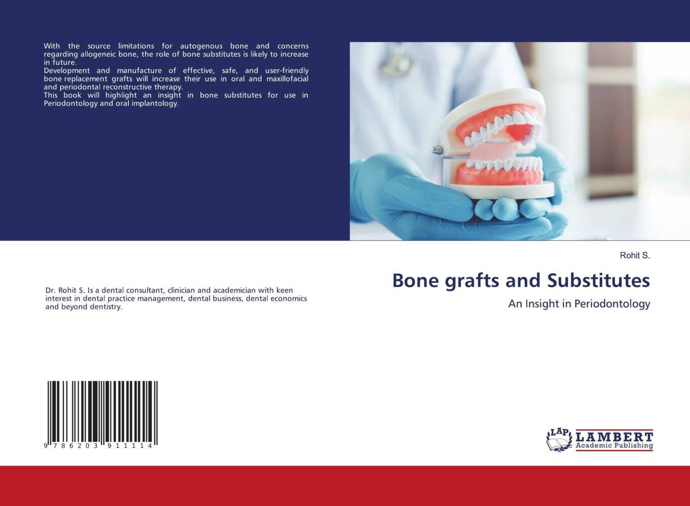 Bone grafts and Substitutes