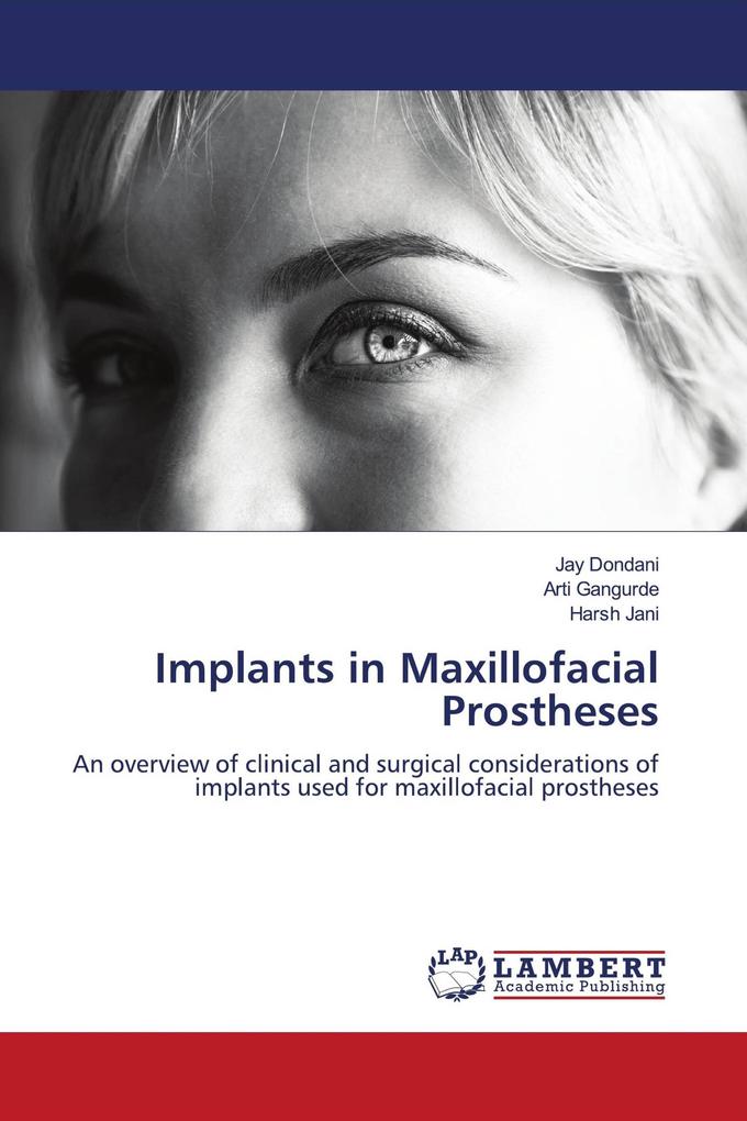Implants in Maxillofacial Prostheses