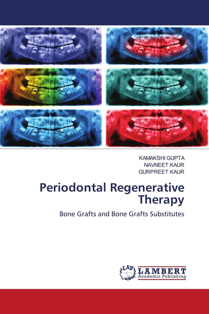 Periodontal Regenerative Therapy