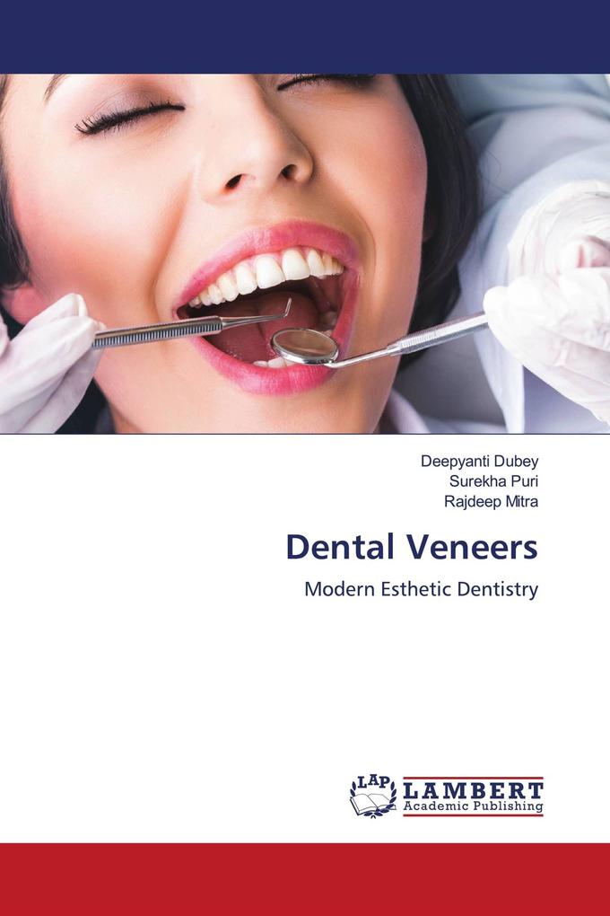 Dental Veneers