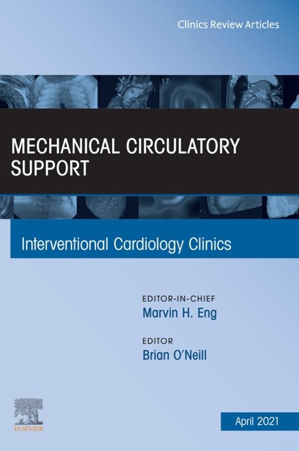 Mechanical Circulatory Support An Issue of Interventional Cardiology Clinics