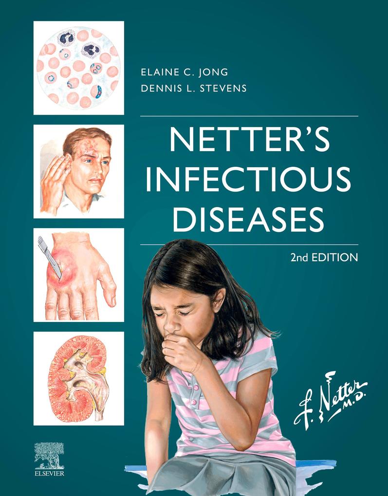 Netter‘s Infectious Diseases - E-Book