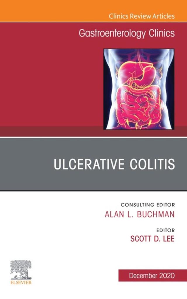 Ulcerative Colitis An Issue of Gastroenterology Clinics of North America E-Book