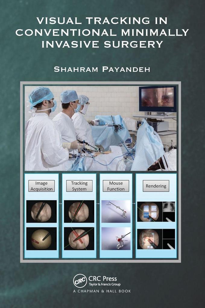 Visual Tracking in Conventional Minimally Invasive Surgery
