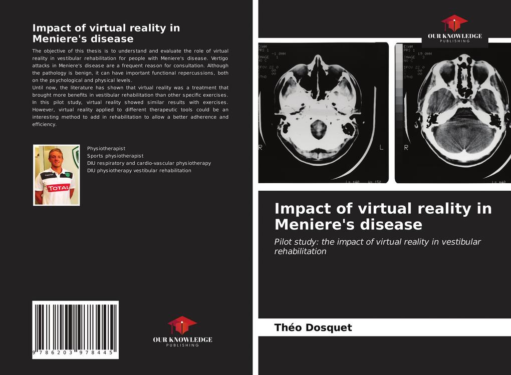 Impact of virtual reality in Meniere‘s disease