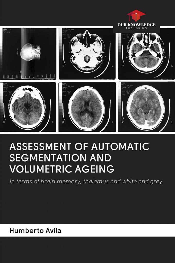 ASSESSMENT OF AUTOMATIC SEGMENTATION AND VOLUMETRIC AGEING