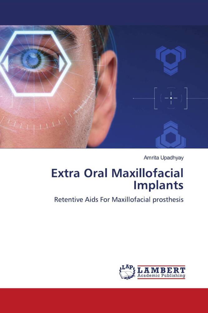 Extra Oral Maxillofacial Implants