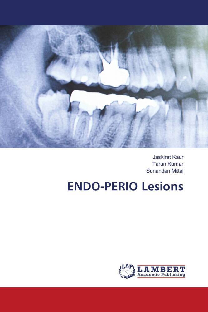 ENDO-PERIO Lesions