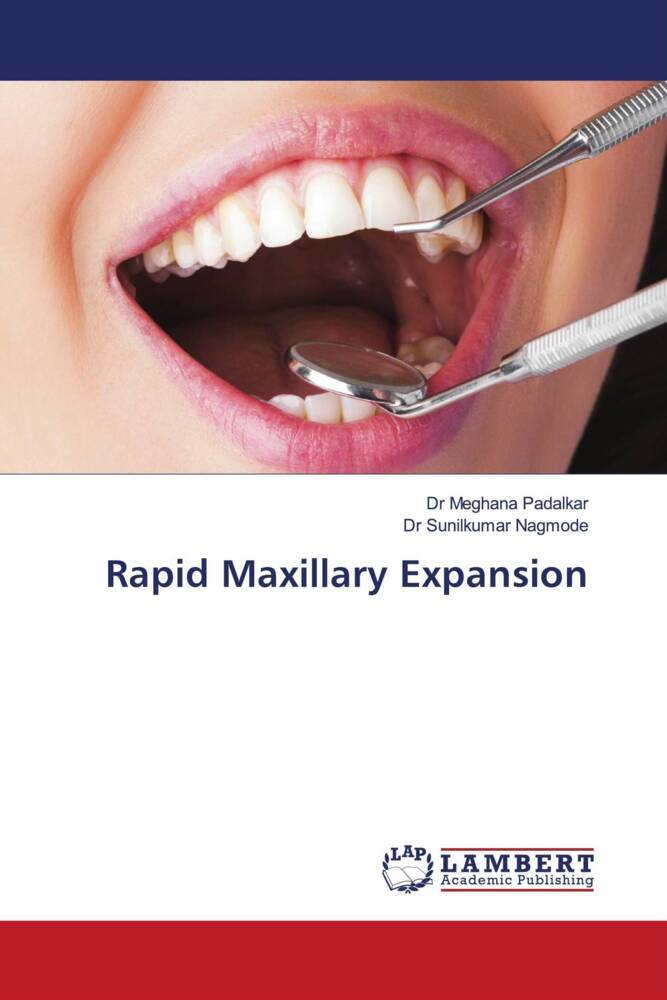 Rapid Maxillary Expansion