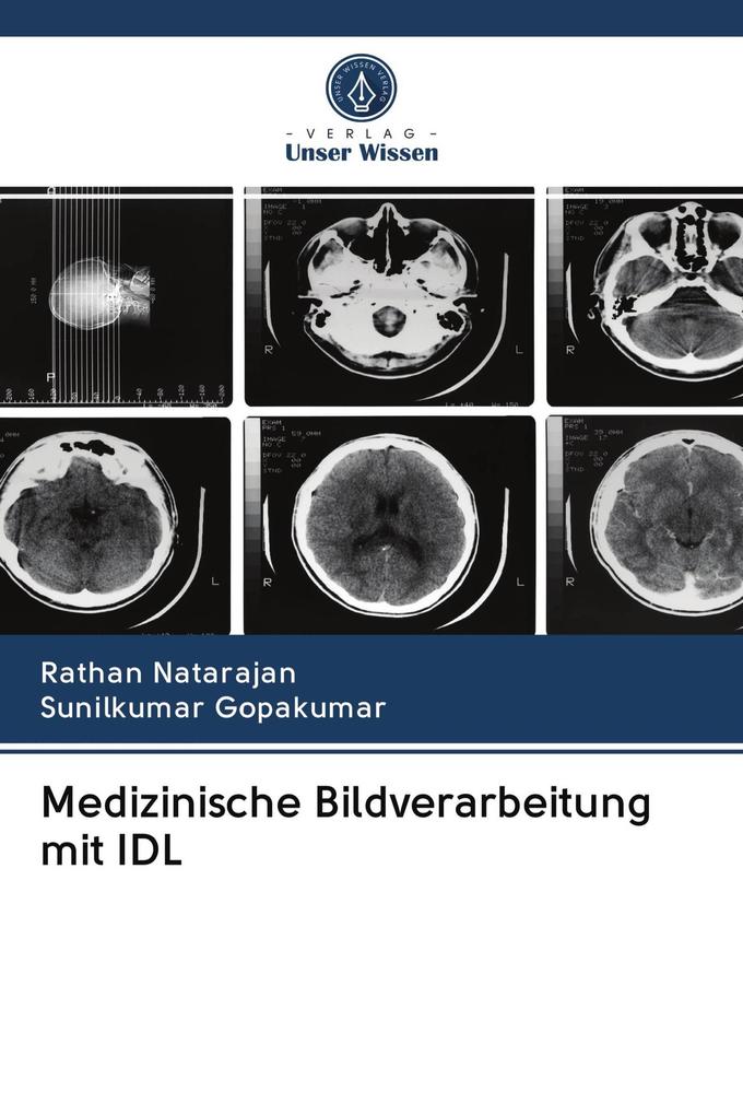 Medizinische Bildverarbeitung mit IDL
